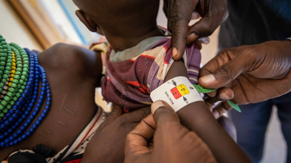 Research accelerator project improving early warning on child malnutrition in Kenya